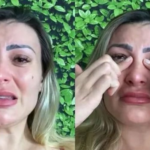 Andressa Urach revela que teme ficar cega; saiba motivo